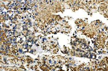 Anti-HDAC4 Antibody