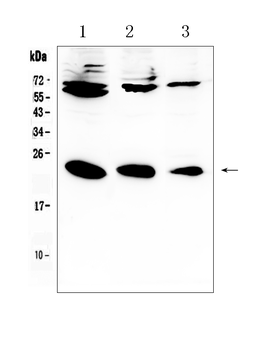 Anti-IL-2/IL2 Antibody