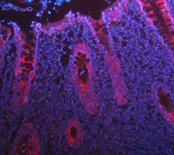 Anti-Cytokeratin 8/KRT8 Antibody