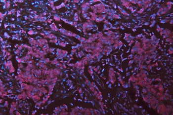 Anti-Musashi 1/Msi1 Antibody