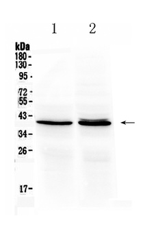 Ornithine Carbamoyltransferase/OTC Antibody
