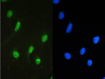 Anti-STAT1 Antibody