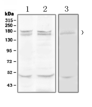 Anti-Thrombospondin/THBS1 Antibody