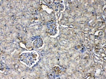 Anti-Thrombopoietin/Thpo Antibody