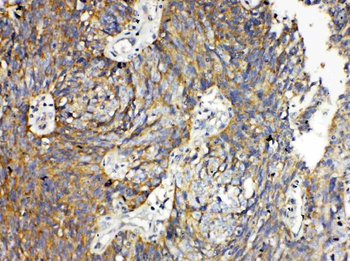 Anti-RANK/TNFRSF11A Antibody