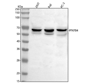 Anti-PFKFB4 Antibody