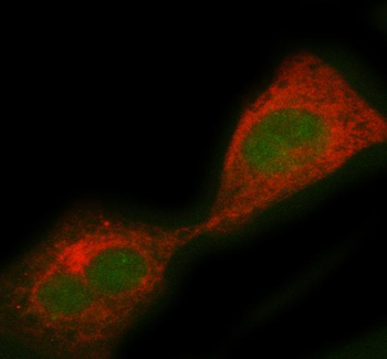 Anti-PCBD1 Antibody