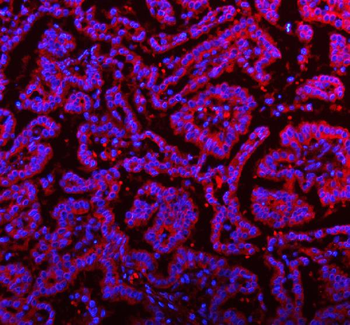 Anti-RNF25 Antibody