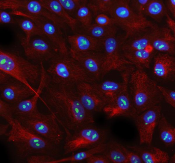 Anti-AATF Antibody