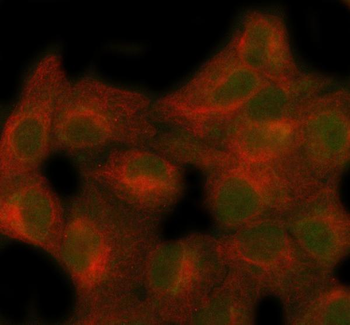 Anti-SECISBP2 Antibody