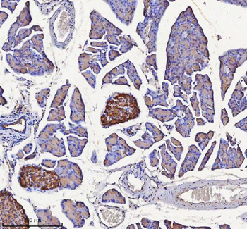 Anti-NPTX2 Antibody