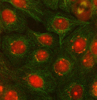 Anti-OTUD5 Antibody