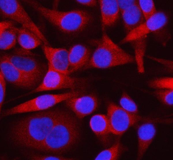 Anti-OTUD3 Antibody
