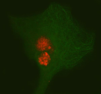 Anti-PAX3 Antibody