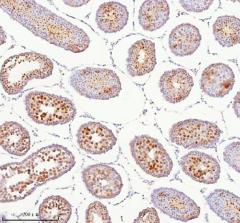 Anti-BCCIP Antibody