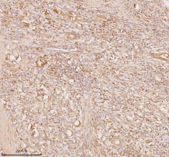 Anti-SSSCA1/ZNRD2 Antibody