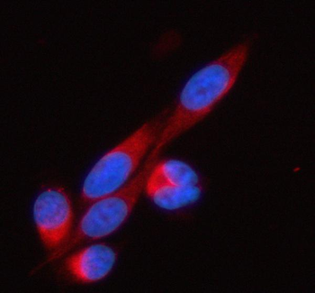 Anti-SOAT1 Antibody