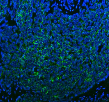 Anti-SPA17 Antibody