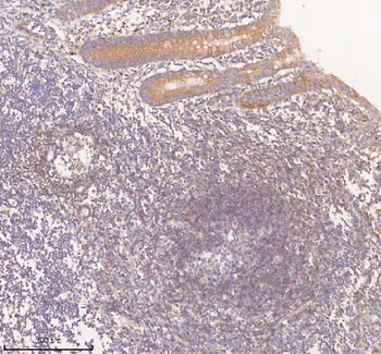 Anti-SCAMP3 Antibody