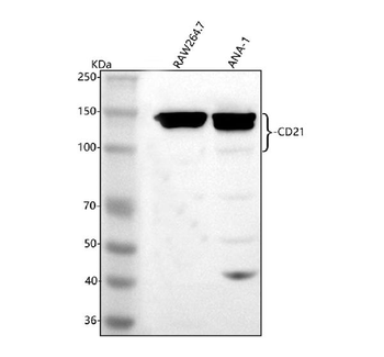 Anti-CD21/CR2 Antibody