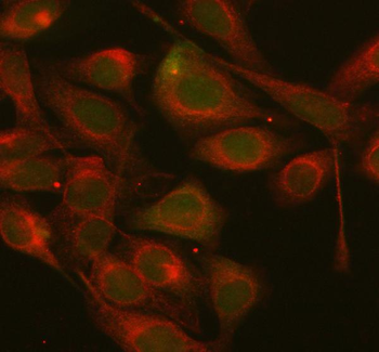 Anti-AXIN1 Antibody