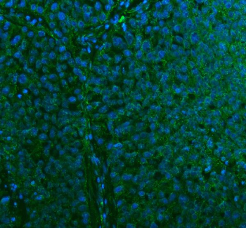 Anti-Stanniocalcin 2/STC2 Antibody