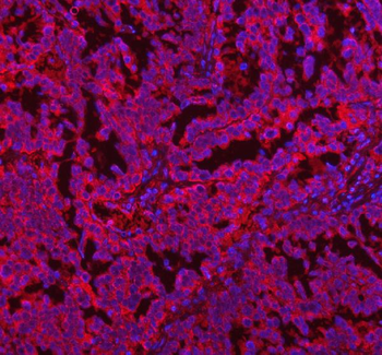 Anti-COQ8B Antibody