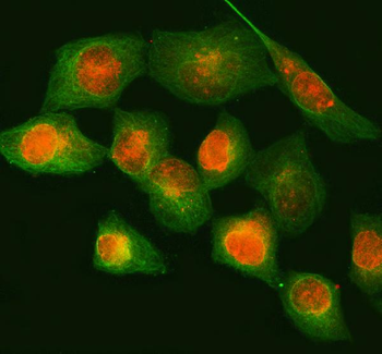 Anti-NUP88 Antibody