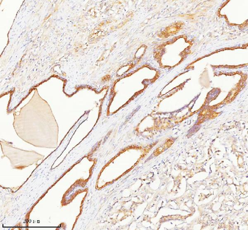 Anti-TNIK Antibody