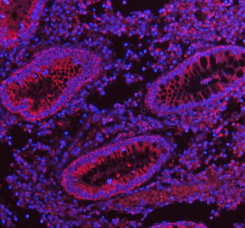 Anti-HERP/HERPUD1 Antibody