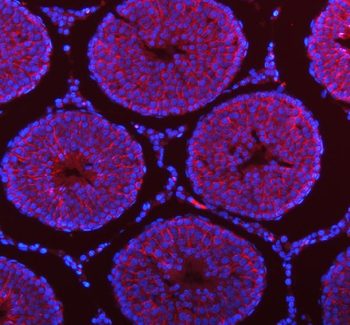 Anti-STIM1 Antibody