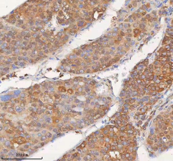Anti-SHKBP1 Antibody