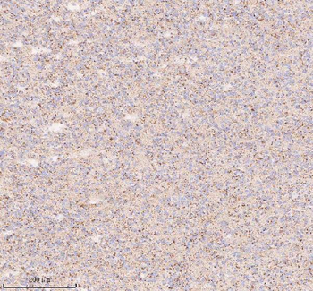 Anti-IRS4 Antibody