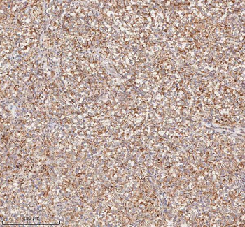 Anti-HDHD5 Antibody