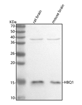 Anti-HBQ1 Antibody