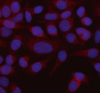 Anti-HADHB Antibody