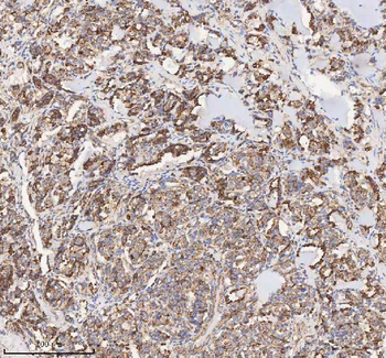 Anti-HADH Antibody