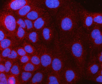 Anti-HAAO Antibody