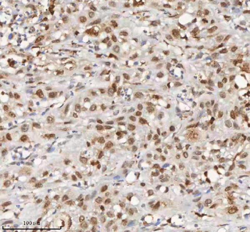 Anti-H2AFY/MACROH2A1 Antibody