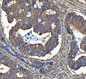 Anti-SEC61G Antibody