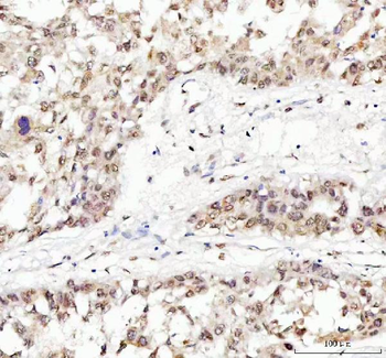 Anti-TDP-43/TARDBP Antibody