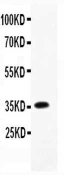 Anti-Macrophage Inflammatory Protein 1 beta/CCL4 Antibody