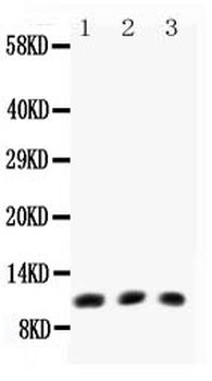 Anti-Eotaxin/CCL11 Antibody