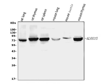 15 Lipoxygenase 1/ALOX15 Antibody