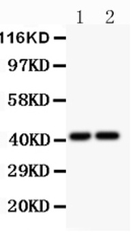 Anti-CXCR3 Antibody