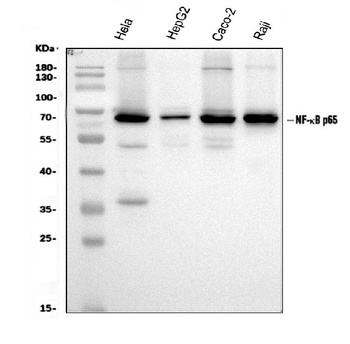 Anti-NF-kB p65/RELA Antibody