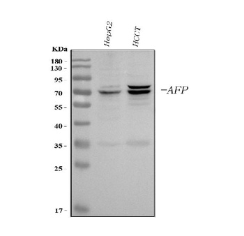 alpha 1 Fetoprotein/AFP Antibody