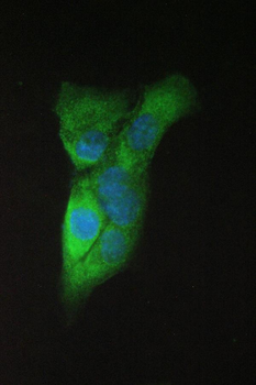 Anti-beta Amyloid/APP Antibody