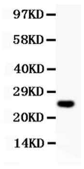 Anti-Cyclin D3/CCND3 Antibody