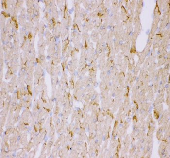 Anti-Desmin Antibody